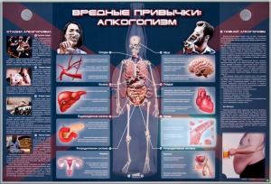 Электрифицированный стенд "Вредные привычки: алкоголизм" - fgospostavki.ru - Томск